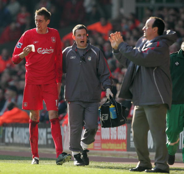 TT可考虑 TT可考虑